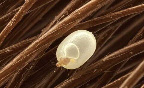 lente poux, reconnaitre et éliminer