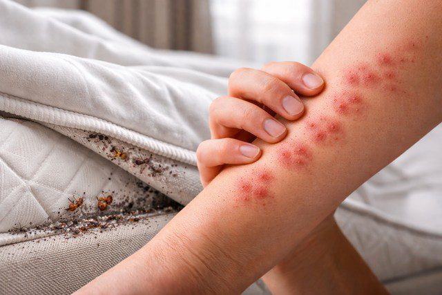 Infestation de punaises de lit